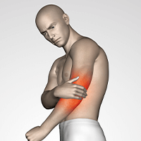 Glutamina - Recuperação